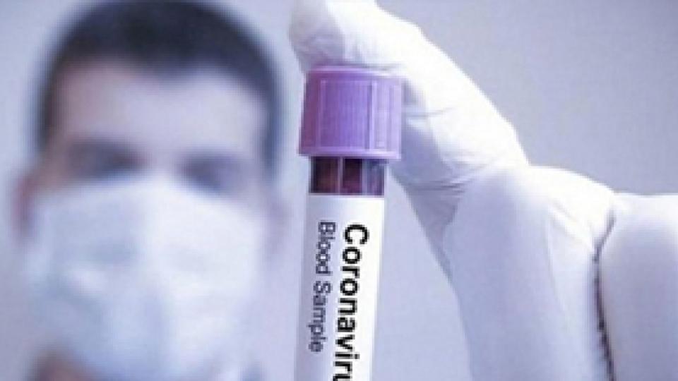 Alibaba is able to Detect the Coronavirus in a Few Seconds